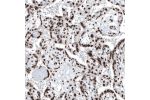Immunohistochemical staining of human placenta shows moderate to strong nuclear positivity in trophoblastic cells.