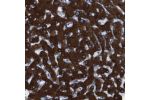 Immunohistochemical staining of human liver shows strong cytoplasmic positivity in hepatocytes.