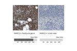 Immunohistochemistry analysis in human parathyroid gland and lymph node tissues using HPA015085 antibody. Corresponding MARC2 RNA-seq data are presented for the same tissues.