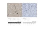 Immunohistochemistry analysis in human cerebral cortex and liver tissues using HPA015103 antibody. Corresponding PTPRZ1 RNA-seq data are presented for the same tissues.