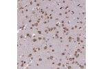 Immunohistochemical staining of human cerebral cortex shows strong cytoplasmic positivity in neurons.