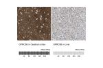 Immunohistochemistry analysis in human cerebral cortex and liver tissues using HPA015247 antibody. Corresponding GPRC5B RNA-seq data are presented for the same tissues.