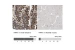 Immunohistochemistry analysis in human small intestine and skeletal muscle tissues using HPA015257 antibody. Corresponding RIPK1 RNA-seq data are presented for the same tissues.