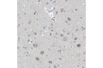 Immunohistochemical staining of human Cerebral cortex shows moderate cytoplasmic positivity in neuronal cells.