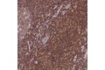 Immunohistochemical staining of human lymph node shows strong cytoplasmic positivity in cells outside reaction centra.
