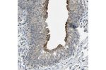 Immunohistochemical staining of human urinary bladder shows moderate to strong cytoplasmic / membranous positivity in urothelial cells.