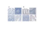 Immunohistochemical staining of human colon, lymph node, ovary and testis using Anti-SALL4 antibody HPA015291 (A) shows similar protein distribution across tissues to independent antibody HPA015791 (B).