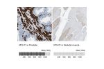 Immunohistochemistry analysis in human prostate and skeletal muscle tissues using HPA015310 antibody. Corresponding MYH11 RNA-seq data are presented for the same tissues.