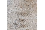 Immunohistochemical staining of human esophagus shows cytoplasmic positivity in squamous epithelial cells.