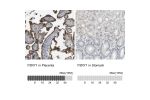 Immunohistochemistry analysis in human placenta and stomach tissues using Anti-P2RY1 antibody. Corresponding P2RY1 RNA-seq data are presented for the same tissues.