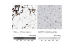 Immunohistochemistry analysis in human bone marrow and cerebral cortex tissues using Anti-SLC4A1 antibody. Corresponding SLC4A1 RNA-seq data are presented for the same tissues.