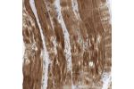 Immunohistochemical staining of human skeletal muscle shows strong cytoplasmic positivity in myocytes.