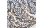 Immunohistochemical staining of human small intestine shows cytoplasmic positivity in glandular cells.