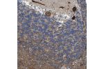 Immunohistochemical staining of human cerebellum shows cytoplasmic and nuclear positivity in Purkinje cells.