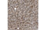 Immunohistochemical staining of human liver shows moderate cytoplasmic positivity in hepatocytes.