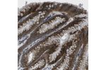 Immunohistochemical staining of human stomach shows strong cytoplasmic positivity in glandular cells.
