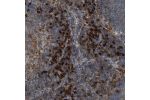 Immunohistochemical staining of human lymph node shows moderate membranous and cytoplasmic positivity in germinal and non-germinal center cells.