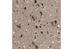 Immunohistochemical staining of human cerebral cortex shows strong cytoplasmic positivity in neuronal cells.