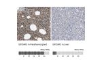 Immunohistochemistry analysis in human parathyroid gland and liver tissues using HPA015737 antibody. Corresponding EIF2AK3 RNA-seq data are presented for the same tissues.