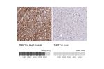 Immunohistochemistry analysis in human heart muscle and liver tissues using HPA015774 antibody. Corresponding TNNT2 RNA-seq data are presented for the same tissues.