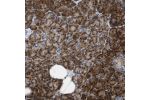 Immunohistochemical staining of human pancreas shows strong cytoplasmic positivity in exocrine glandular cells.