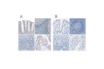 Immunohistochemical staining of human colon, lymph node, ovary and testis using Anti-SALL4 antibody HPA015791 (A) shows similar protein distribution across tissues to independent antibody HPA015291 (B).