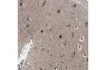 Immunohistochemical staining of human kidney shows cytoplasmic positivity in cells in tubules.