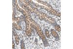 Immunohistochemical staining of human colon shows cytoplasmic positivity in glandular cells.