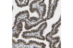Immunohistochemical staining of human fallopian tube shows strong nuclear positivity in glandular cells.