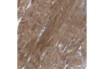 Immunohistochemical staining of human skeletal muscle shows strong cytoplasmic positivity in myocytes.