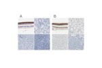 Immunohistochemical staining of human eye, retina, kidney, liver and pancreas using Anti-IMPG2 antibody HPA015907 (A) shows similar protein distribution across tissues to independent antibody HPA008779 (B).