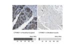 Immunohistochemistry analysis in human parathyroid gland and skeletal muscle tissues using Anti-CTNND1 antibody. Corresponding CTNND1 RNA-seq data are presented for the same tissues.