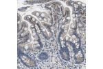 Immunohistochemical staining of human small intestine shows cytoplasmic and membranous positivity in glandular cells.