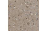 Immunohistochemical staining of human cerebral cortex shows moderate cytoplasmic positivity in neurons.