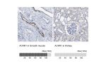Immunohistochemistry analysis in human smooth muscle and kidney tissues using Anti-ACKR1 antibody. Corresponding ACKR1 RNA-seq data are presented for the same tissues.