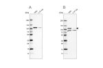 Western blot analysis using Anti-SRPK1 antibody HPA016431 (A) shows similar pattern to independent antibody HPA056486 (B).