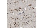 Immunohistochemical staining of human Cerebral cortex shows strong cytoplasmic positivity in neuronal cells.