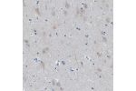 Immunohistochemical staining of human cerebral cortex shows weak to moderate cytoplasmic positivity in neurons.