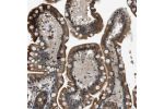 Immunohistochemical staining of human Small intestine shows moderate cytoplasmic positivity in glandular cells.