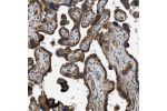 Immunohistochemical staining of human placenta shows strong cytoplasmic positivity in Trophoblasts.