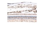 Immunohistochemical staining of human liver shows strong cytoplasmic positivity in Kupffer cells.