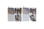 Immunohistochemical staining of human cerebellum, colon, liver and prostate using Anti-WNK2 antibody HPA016519 (A) shows similar protein distribution across tissues to independent antibody HPA015555 (B).