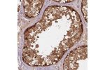 Immunohistochemical staining of human Testis shows strong membranous and cytoplasmic positivity in spermatogonia and cells in seminiferous ducts.