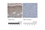 Immunohistochemistry analysis in human skin and pancreas tissues using HPA016583 antibody. Corresponding ORAI1 RNA-seq data are presented for the same tissues.