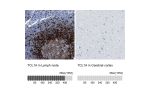 Immunohistochemistry analysis in human lymph node and cerebral cortex tissues using HPA016604 antibody. Corresponding TCL1A RNA-seq data are presented for the same tissues.