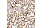 Immunohistochemical staining of human lactating breast shows strong positivity in glandular cells.