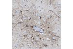 Immunohistochemical staining of human cerebral cortex shows moderate membranous positivity in astrocytes.