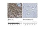 Immunohistochemistry analysis in human liver and skeletal muscle tissues using HPA016646 antibody. Corresponding ASL RNA-seq data are presented for the same tissues.