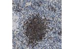 Immunohistochemical staining of human spleen shows strong cytoplasmic positivity in the white pulp.