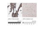 Immunohistochemistry analysis in human parathyroid gland and skeletal muscle tissues using HPA016699 antibody. Corresponding CBX5 RNA-seq data are presented for the same tissues.